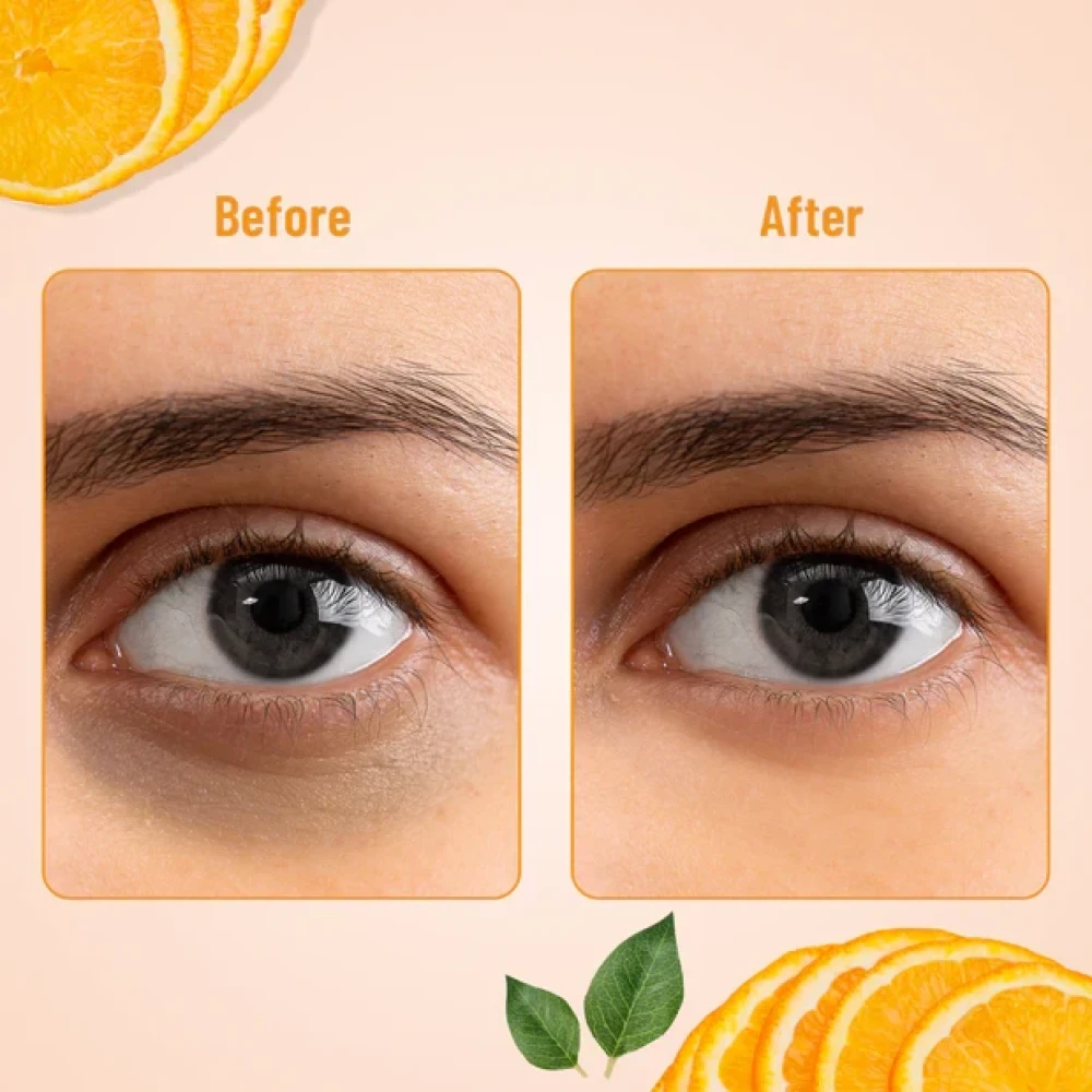 Swiss Beauty Hydra Eye Serum Patch Vitamin C