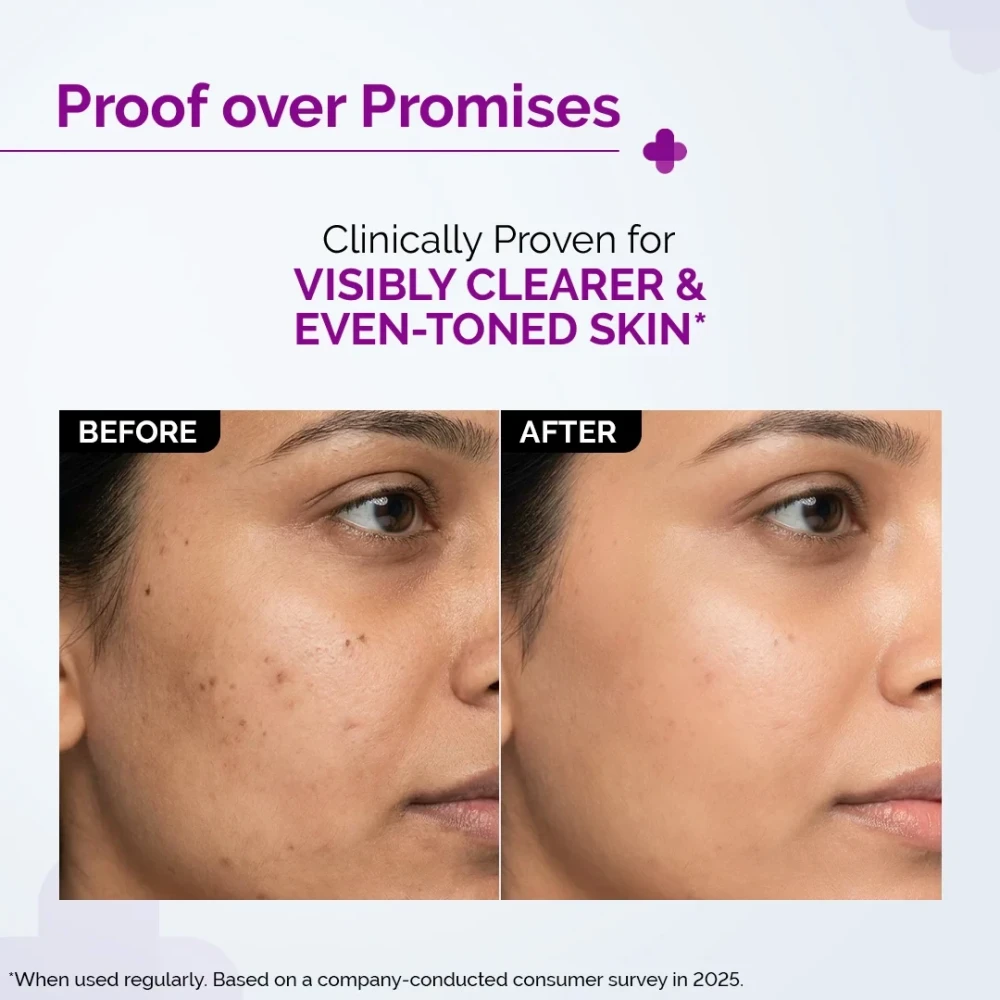 The Derma Co 10% Niacinamide Face Serum for Acne Marks