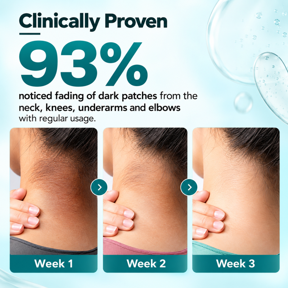 Fixderma Nigrifix Cream for Acanthosis Nigricans